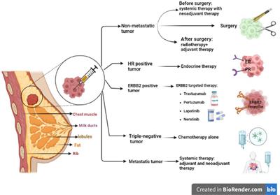 Autophagy modulation in breast cancer utilizing nanomaterials and nanoparticles